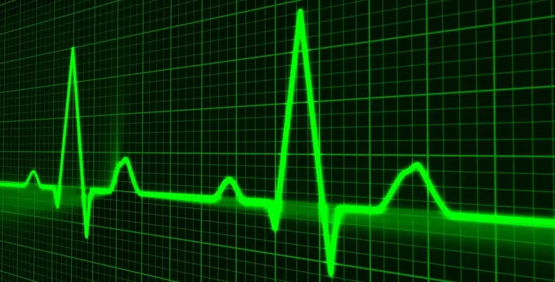 HRV as a Tool to Measure the Long-Term Cost of Training