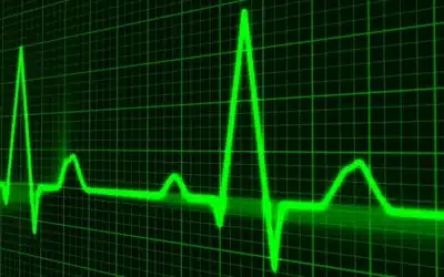 HRV as a Tool to Measure the Long-Term Cost of Training