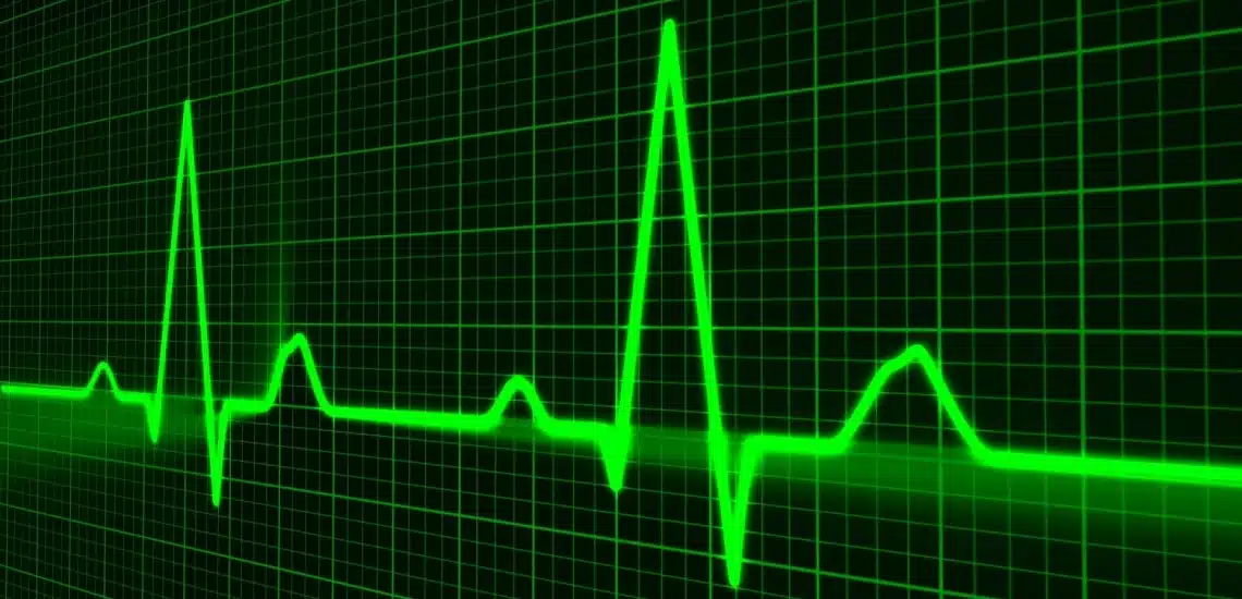 Green electrocardiogram Green electrocardiogram