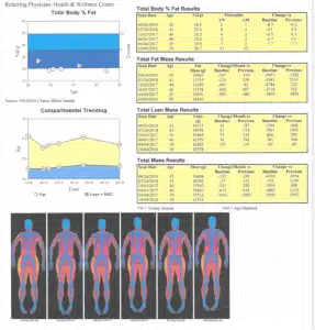 Body Composition Progress Report Total Body % Fat, Fat Mass, and Lean Mass Trends